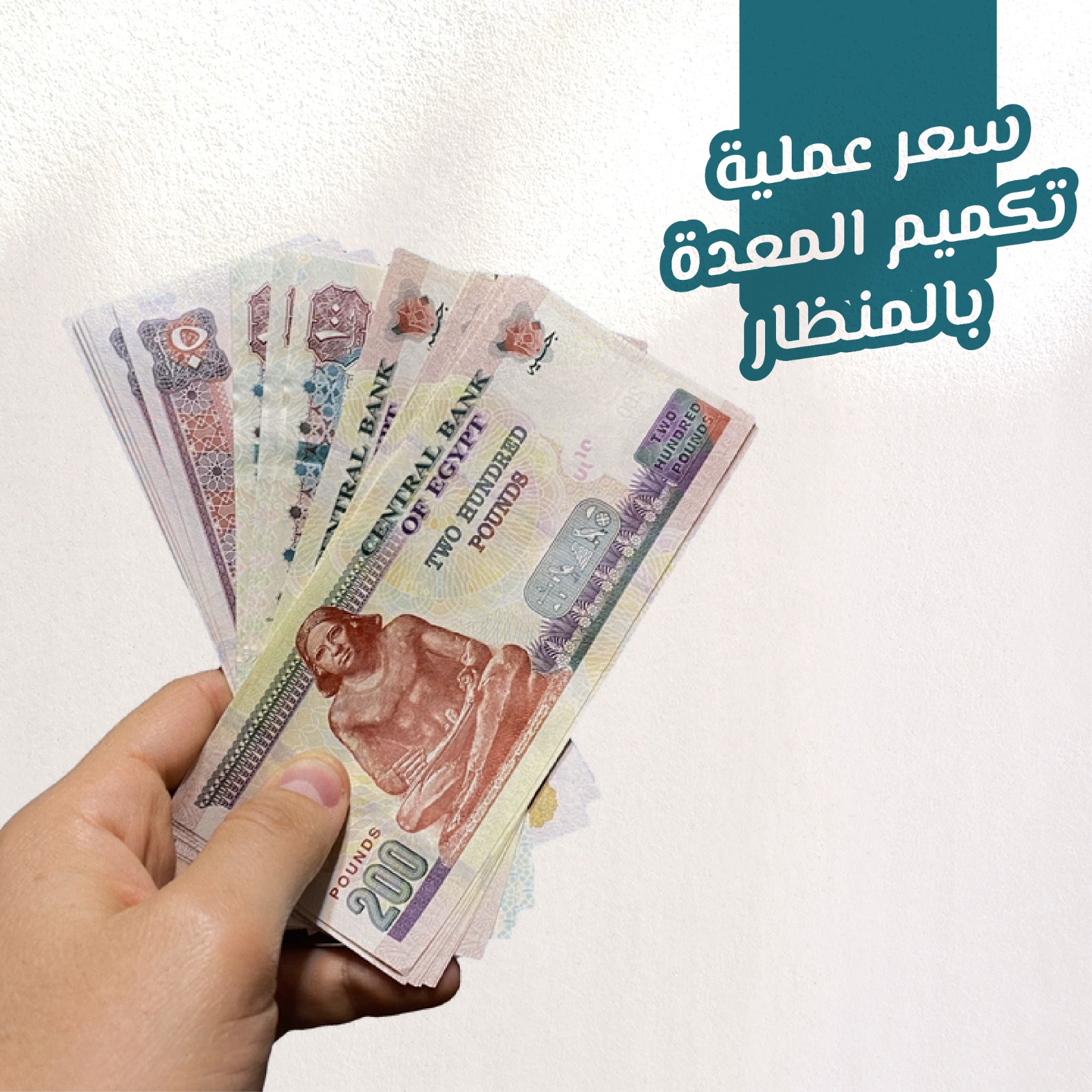 سعر عملية تكميم المعدة بالمنظار