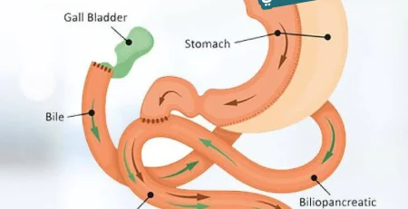 عملية تحويل المسار الساسي