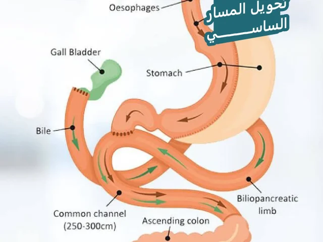 عملية تحويل المسار الساسي