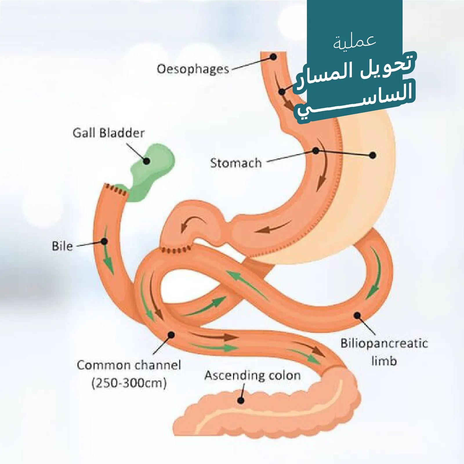 عملية تحويل المسار الساسي